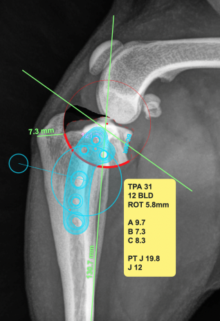 Abmessungen und genaue virtuelle Planung der OP anhand der Röntgenbilder