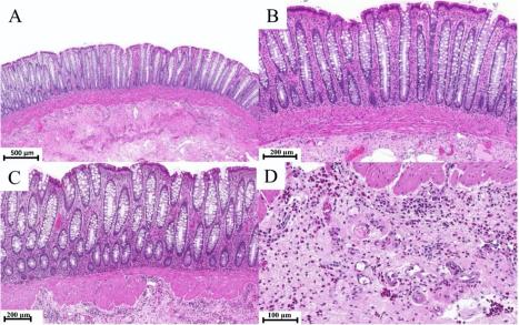 Rektalschleimhaut