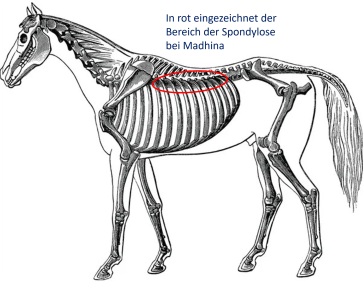 Schematische Darstellung der betroffenen Wirbelkörper der Brustwirbelsaule
