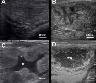 Ultraschallbilder (Querschnitte) von gesunden und entzündlich veränderten Gebärmutterhörnern