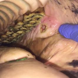 Schleimhautverletzung